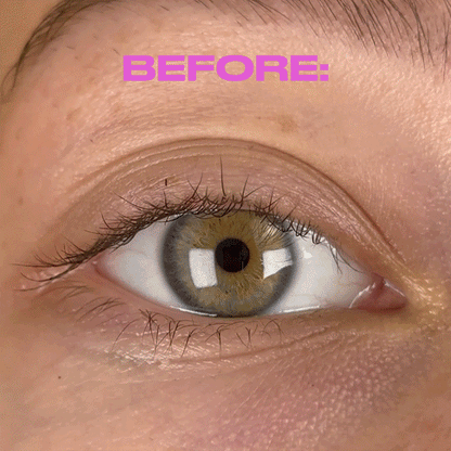 Elektryczna Zalotka Do Podkręcania Rzęs Superlash™